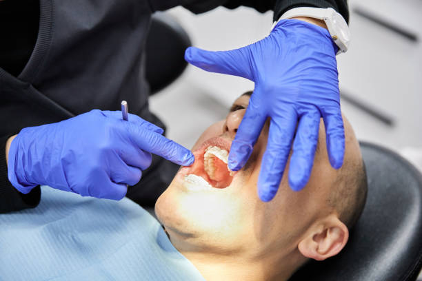 Best Emergency Dentist for Lost Fillings or Crowns in Southgate, FL